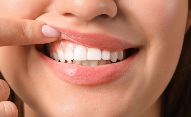 Zahnpflege Mundschleimhaut Zahnfleisch