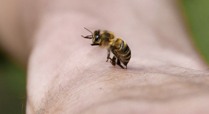 Bienen Stechtherapie - Honiggesundheit